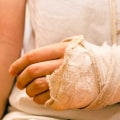 What classifies as a personal injury?