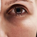 What are the 6 types of injuries?