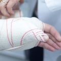 What counts as a serious injury?